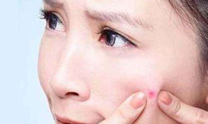 如何快速治愈囊腫型痘痘痤瘡. 