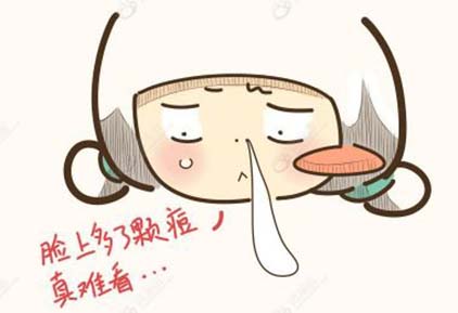 長了痘痘怎么才能消除 吃什么食物可以祛痘
