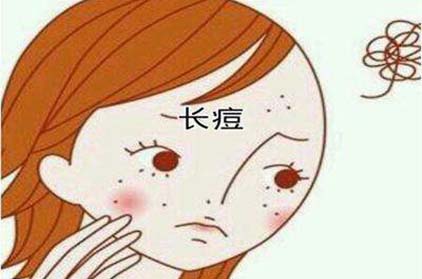 臉上長痘痘怎么能有效的去除 去除痘痘有哪些誤區