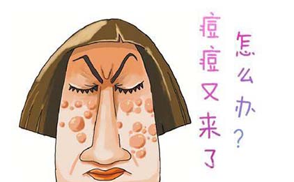 祛痘達人分享：祛痘就是這么簡單