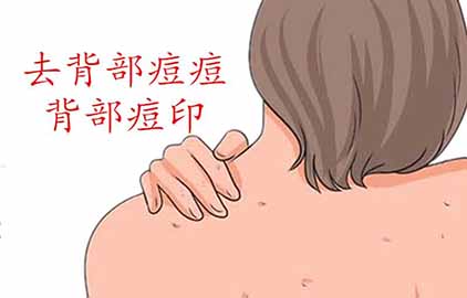背后長痘痘是什么原因導致的 背后長痘用什么沐浴露好