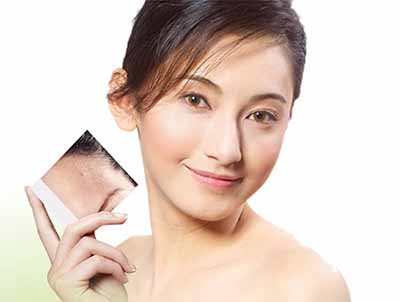 /生活中比較好的去痘痘小妙招