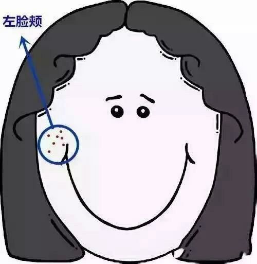 左臉頰長痘痘護理方法