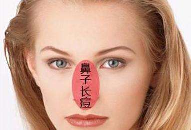鼻子上長痘痘護理方法方法